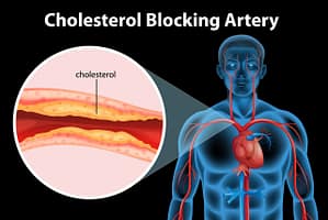 Goede en slechte cholesterol